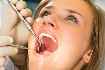 Dental Treatments